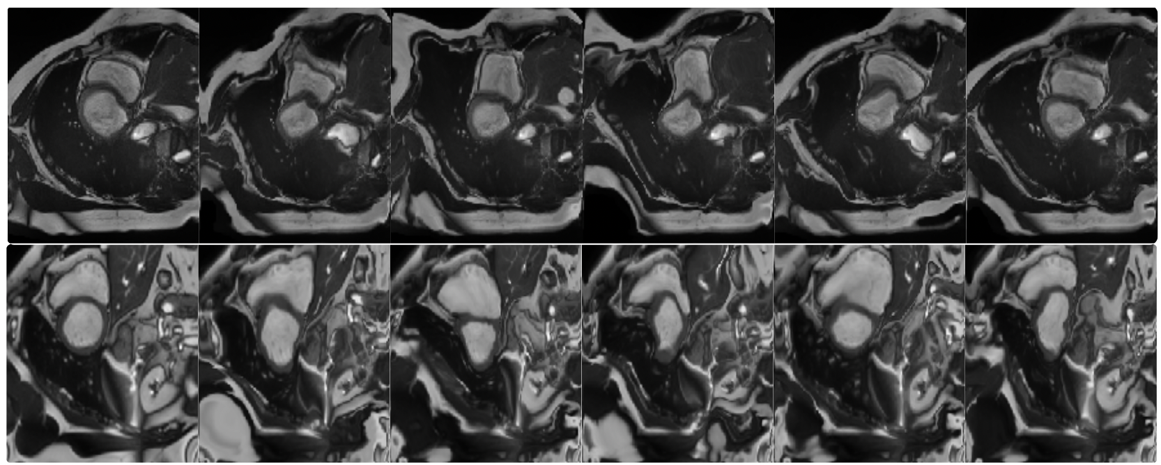 Semi-supervised and Task-Driven Data Augmentation